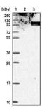 TBC1 Domain Family Member 16 antibody, PA5-55089, Invitrogen Antibodies, Western Blot image 