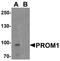 Prominin 1 antibody, PA5-38014, Invitrogen Antibodies, Western Blot image 