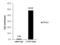 CCAAT Enhancer Binding Protein Beta antibody, GTX100675, GeneTex, Chromatin Immunoprecipitation image 