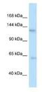 Tau Tubulin Kinase 2 antibody, NBP1-82388, Novus Biologicals, Western Blot image 