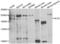 Alsin Rho Guanine Nucleotide Exchange Factor ALS2 antibody, LS-C346241, Lifespan Biosciences, Western Blot image 