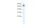 Zinc Finger Protein 57 antibody, A17280, Boster Biological Technology, Western Blot image 