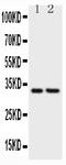 CD20 antibody, LS-C313533, Lifespan Biosciences, Western Blot image 