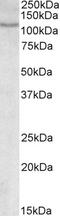 SLAIN Motif Family Member 2 antibody, 42-167, ProSci, Enzyme Linked Immunosorbent Assay image 