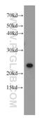 MOB Family Member 4, Phocein antibody, 15886-1-AP, Proteintech Group, Western Blot image 