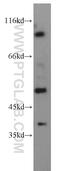 Phosphodiesterase 6C antibody, 55183-1-AP, Proteintech Group, Western Blot image 