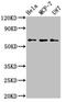 Kyphoscoliosis Peptidase antibody, CSB-PA012702LA01HU, Cusabio, Western Blot image 