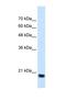 Signal Sequence Receptor Subunit 2 antibody, NBP1-69471, Novus Biologicals, Western Blot image 