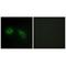 Protein Kinase C Substrate 80K-H antibody, A04992, Boster Biological Technology, Immunohistochemistry frozen image 