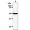 RuvB Like AAA ATPase 1 antibody, GTX57672, GeneTex, Western Blot image 