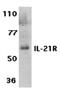 Interleukin 21 Receptor antibody, orb74450, Biorbyt, Western Blot image 