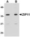 Zinc transporter ZIP11 antibody, A13919, Boster Biological Technology, Western Blot image 