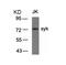 Spleen Associated Tyrosine Kinase antibody, 79-434, ProSci, Western Blot image 