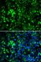 Potassium Voltage-Gated Channel Subfamily A Member 2 antibody, LS-B16482, Lifespan Biosciences, Immunofluorescence image 