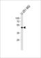 Y-Box Binding Protein 1 antibody, MBS9202479, MyBioSource, Western Blot image 