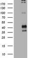 Fc Fragment Of IgE Receptor II antibody, TA801571AM, Origene, Western Blot image 