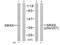 Mitogen-Activated Protein Kinase Kinase 3 antibody, TA312052, Origene, Western Blot image 