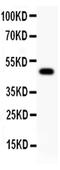 LDL Receptor Related Protein 1 antibody, PA5-79612, Invitrogen Antibodies, Western Blot image 