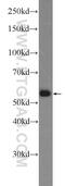 Serum Amyloid A Like 1 antibody, 25467-1-AP, Proteintech Group, Western Blot image 