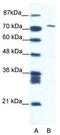 Mastermind Like Domain Containing 1 antibody, TA335711, Origene, Western Blot image 