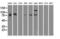B-Raf Proto-Oncogene, Serine/Threonine Kinase antibody, LS-C784264, Lifespan Biosciences, Western Blot image 