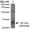 G Protein-Coupled Receptor Kinase 5 antibody, LS-C775070, Lifespan Biosciences, Western Blot image 