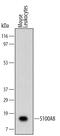 S100 Calcium Binding Protein A8 antibody, MA5-24066, Invitrogen Antibodies, Western Blot image 