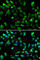 SATB Homeobox 1 antibody, A5800, ABclonal Technology, Immunofluorescence image 