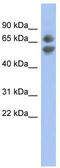 Programmed Cell Death 7 antibody, TA344205, Origene, Western Blot image 