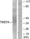 Prostate Transmembrane Protein, Androgen Induced 1 antibody, TA315633, Origene, Western Blot image 