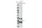 Leucine Rich Repeat Kinase 2 antibody, 5559S, Cell Signaling Technology, Western Blot image 