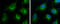 Acyl-CoA Synthetase Long Chain Family Member 4 antibody, GTX633365, GeneTex, Immunofluorescence image 