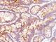 Carcinoembryonic Antigen Related Cell Adhesion Molecule 5 antibody, NBP2-44901, Novus Biologicals, Immunohistochemistry frozen image 