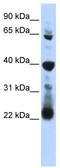 RNA Pseudouridine Synthase D3 antibody, TA344022, Origene, Western Blot image 