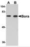 BORA Aurora Kinase A Activator antibody, 5107, ProSci, Western Blot image 