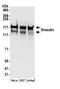 Kinectin 1 antibody, A304-384A, Bethyl Labs, Western Blot image 