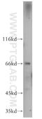 CTP Synthase 2 antibody, 12852-1-AP, Proteintech Group, Western Blot image 