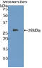 Chromodomain Helicase DNA Binding Protein 3 antibody, LS-C293330, Lifespan Biosciences, Western Blot image 