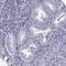Transketolase Like 1 antibody, HPA000505, Atlas Antibodies, Immunohistochemistry paraffin image 