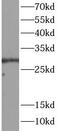 DDIT3 antibody, FNab10045, FineTest, Western Blot image 