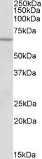 Acyl-CoA Dehydrogenase Very Long Chain antibody, GTX88173, GeneTex, Western Blot image 