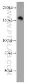 Rho Associated Coiled-Coil Containing Protein Kinase 2 antibody, 21645-1-AP, Proteintech Group, Western Blot image 