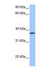 Ubiquitin Like Modifier Activating Enzyme 5 antibody, NBP1-59517, Novus Biologicals, Western Blot image 