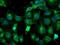 Tubulin Alpha Like 3 antibody, NBP2-01476, Novus Biologicals, Immunocytochemistry image 