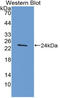 TIMP Metallopeptidase Inhibitor 4 antibody, LS-C296678, Lifespan Biosciences, Western Blot image 