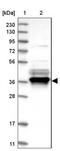 NFKB Inhibitor Alpha antibody, NBP1-87761, Novus Biologicals, Western Blot image 