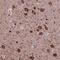 Protein Inhibitor Of Activated STAT 3 antibody, NBP2-48503, Novus Biologicals, Immunohistochemistry frozen image 