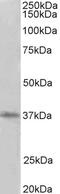 Protein Arginine Methyltransferase 2 antibody, STJ72813, St John