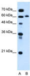 ITPRIP Like 1 antibody, TA336137, Origene, Western Blot image 