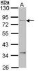 Carcinoembryonic Antigen Related Cell Adhesion Molecule 1 antibody, PA5-29720, Invitrogen Antibodies, Western Blot image 